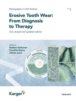 Erosive Tooth Wear: From Diagnosis to Therapy, 3rd Edition (EPUB)