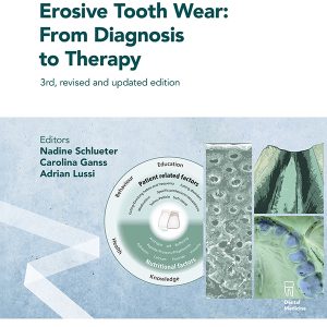 Erosive Tooth Wear: From Diagnosis to Therapy, 3rd Edition (Original PDF from Publisher)