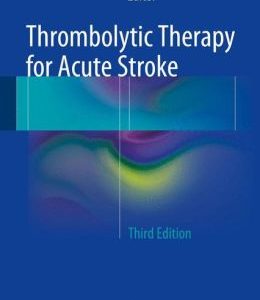 Thrombolytic Therapy for Acute Stroke