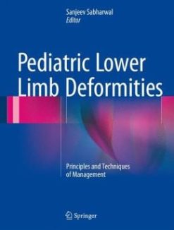 Pediatric Lower Limb Deformities: Principles and Techniques of Management