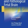 The Normal and Pathological Fetal Brain: Ultrasonographic Features (Original PDF from Publisher)