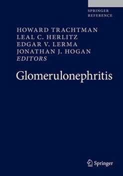 Glomerulonephritis (Original PDF from Publisher)