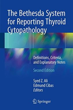 The Bethesda System for Reporting Thyroid Cytopathology: Definitions, Criteria, and Explanatory Notes (PDF)