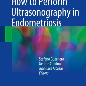 How to Perform Ultrasonography in Endometriosis (Original PDF from Publisher)