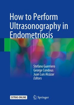 How to Perform Ultrasonography in Endometriosis (EPUB)