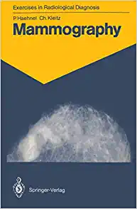 Mammography: 83 Radiological Exercises for Students and Practitioners (Exercises in Radiological Diagnosis) (Original PDF from Publisher)