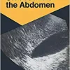 Ultrasound of the Abdomen: 114 Radiological Exercises for Students and Practitioners (Exercises in Radiological Diagnosis) (Original PDF from Publisher)