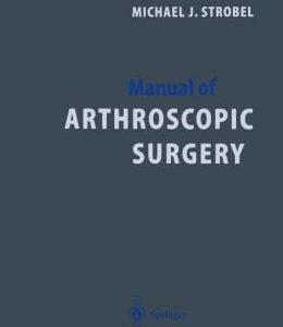 Manual of Arthroscopic Surgery