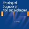 Histological Diagnosis of Nevi and Melanoma