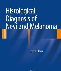 Histological Diagnosis of Nevi and Melanoma