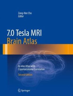 7.0 Tesla MRI Brain Atlas: In-vivo Atlas with Cryomacrotome Correlation