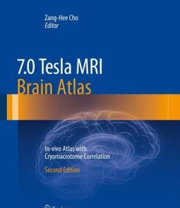 7.0 Tesla MRI Brain Atlas: In-vivo Atlas with Cryomacrotome Correlation