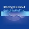 Radiology Illustrated: Gastrointestinal Tract