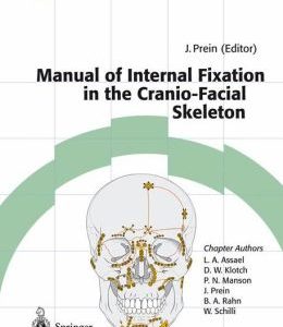 Manual of Internal Fixation in the Cranio-Facial Skeleton: Techniques Recommended by the AO/ASIF Maxillofacial Group