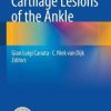 Cartilage Lesions of the Ankle (Original PDF from Publisher)