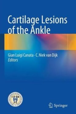 Cartilage Lesions of the Ankle (Original PDF from Publisher)
