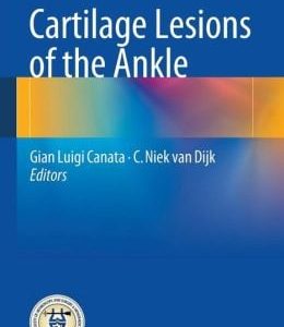 Cartilage Lesions of the Ankle (Original PDF from Publisher)