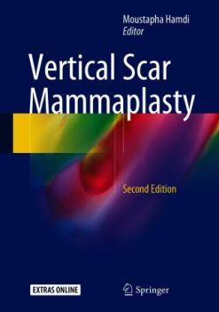 Vertical Scar Mammaplasty, 2nd Edition (EPUB)