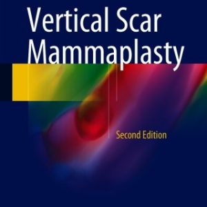 Vertical Scar Mammaplasty, 2nd Edition (EPUB)