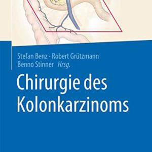 Chirurgie des Kolonkarzinoms (German Edition) (Original PDF from Publisher)