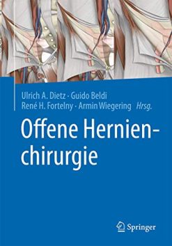 Offene Hernienchirurgie (German Edition) (Original PDF from Publisher)