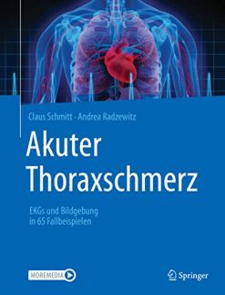 Akuter Thoraxschmerz: EKGs und Bildgebung in 65 Fallbeispielen (German Edition) (Original PDF from Publisher)