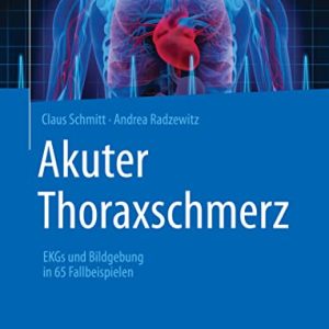 Akuter Thoraxschmerz: EKGs und Bildgebung in 65 Fallbeispielen (German Edition) (Original PDF from Publisher)