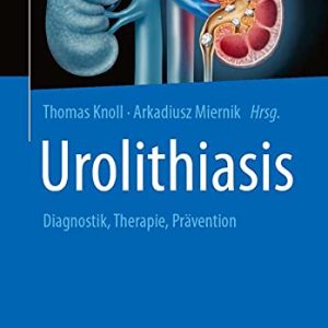 Urolithiasis: Diagnostik, Therapie, Prävention (German Edition) (Original PDF from Publisher)