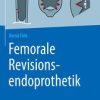 Femorale Revisionsendoprothetik (Original PDF from Publisher)
