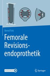 Femorale Revisionsendoprothetik (Original PDF from Publisher)
