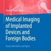 Medical Imaging of Implanted Devices and Foreign Bodies, 2024th Edition (Original PDF from Publisher)