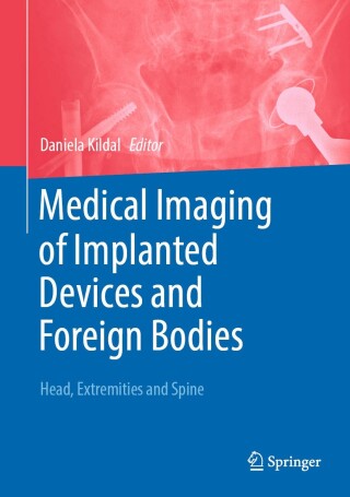 Medical Imaging of Implanted Devices and Foreign Bodies, 2024th Edition (Original PDF from Publisher)