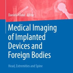 Medical Imaging of Implanted Devices and Foreign Bodies, 2024th Edition (EPUB)