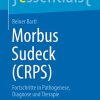 Morbus Sudeck (CRPS): Fortschritte in Pathogenese, Diagnose und Therapie (essentials) (German Edition) (Original PDF from Publisher)