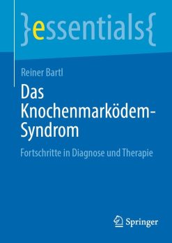 Das Knochenmarködem-Syndrom: Fortschritte in Diagnose und Therapie (Original PDF from Publisher)