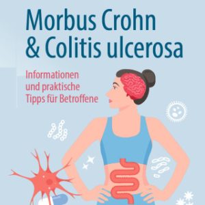 Morbus Crohn und Colitis ulcerosa (EPUB)