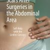 Scars After Surgeries in the Abdominal Area: Self-Help with the Liedler-Concept (EPUB)