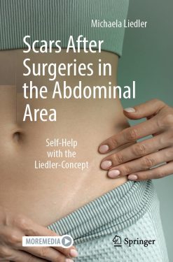 Scars After Surgeries in the Abdominal Area: Self-Help with the Liedler-Concept (EPUB)