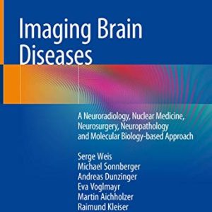 Imaging Brain Diseases: A Neuroradiology, Nuclear Medicine, Neurosurgery, Neuropathology and Molecular Biology-based Approach (Original PDF from Publisher)