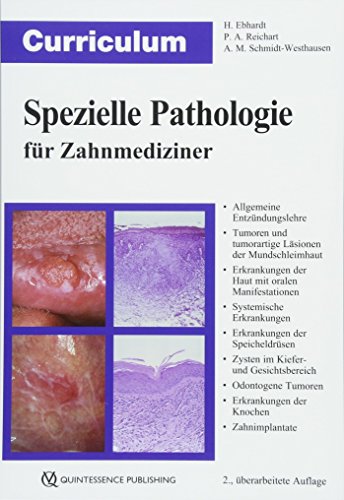 Curriculum Spezielle Pathologie für Zahnmediziner (EPUB)