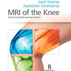MRI of the Knee: Second revised & expanded edition (Original PDF from Publisher)