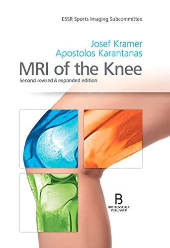 MRI of the Knee: Second revised & expanded edition (Original PDF from Publisher)