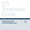 ITI Treatment Guide, Volume 3: Implant Placement in Post-Extraction Sites: Treatment Options (ITI Treatment Guides)