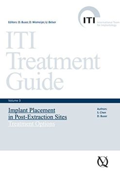 ITI Treatment Guide, Volume 3: Implant Placement in Post-Extraction Sites: Treatment Options (ITI Treatment Guides)