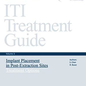 ITI Treatment Guide, Volume 3: Implant Placement in Post-Extraction Sites: Treatment Options (ITI Treatment Guides)