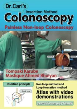 Dr. Carl’s Colonoscopy insertion method: Painless Non-loop Colonoscopy (AZW 3 + EPUB + Converted PDF)