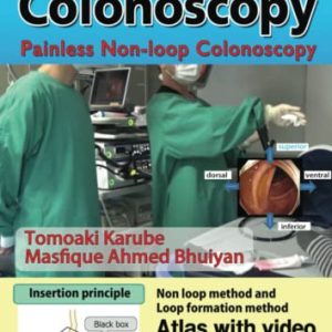 Dr. Carl’s Colonoscopy insertion method: Painless Non-loop Colonoscopy (AZW 3 + EPUB + Converted PDF)