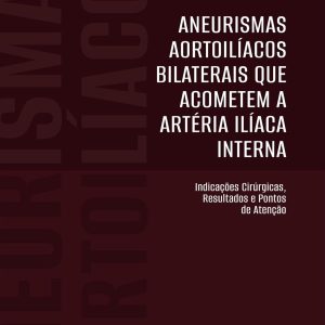 Aneurismas Aortoilíacos Bilaterais que Acometem a Artéria Ilíaca Interna: Indicações Cirúrgicas, Resultados e Pontos de Atenção (Portuguese Edition) (EPUB)