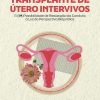 Transplante de Útero Intervivos: A (im)Possibilidade de Realização da Conduta à Luz da Perspectiva Biojurídica (Portuguese Edition) (EPUB)
