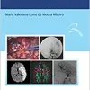 Doença Cerebrovascular na Infância e Adolescência (Original PDF from Publisher)